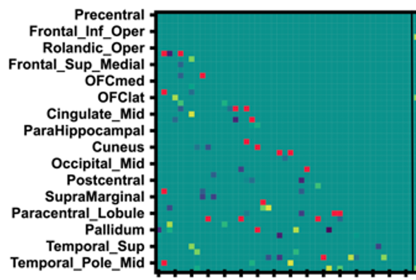 Considering dynamic nature of the brain: the clinical importance of connectivity variability in machine learning classification and prediction