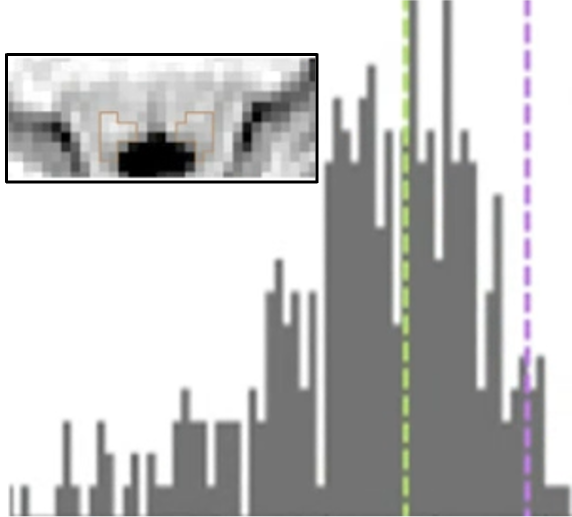 Automated Locus Coeruleus segmentation and age-related signal changes across Neuromelanin-sensitive MRI and T1/T2-weighted images
